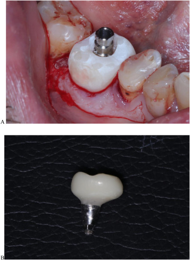 1-s2-0-S2950643325000522-gr5