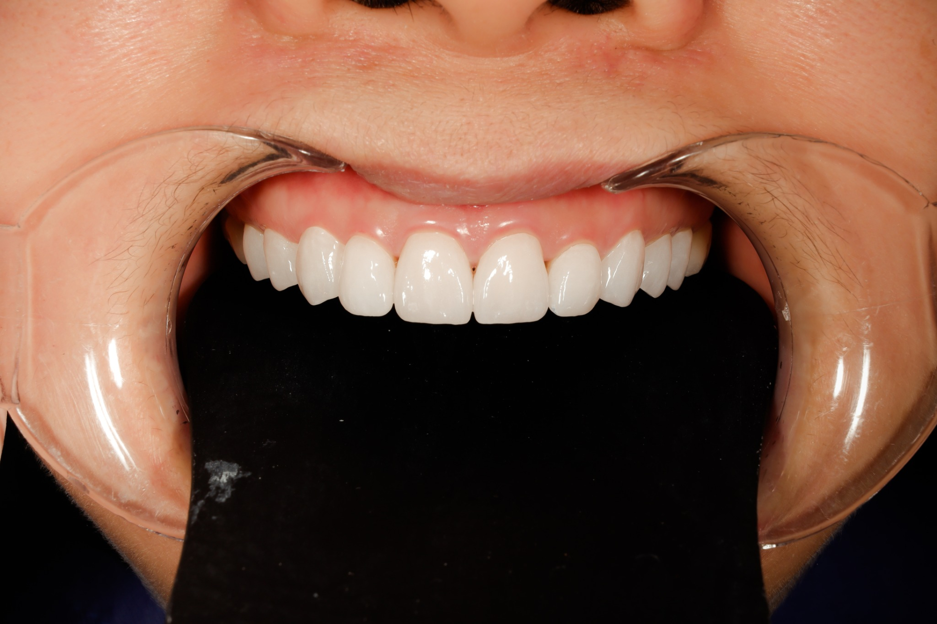 472403880_122253926990006399_6251522864264242434_n